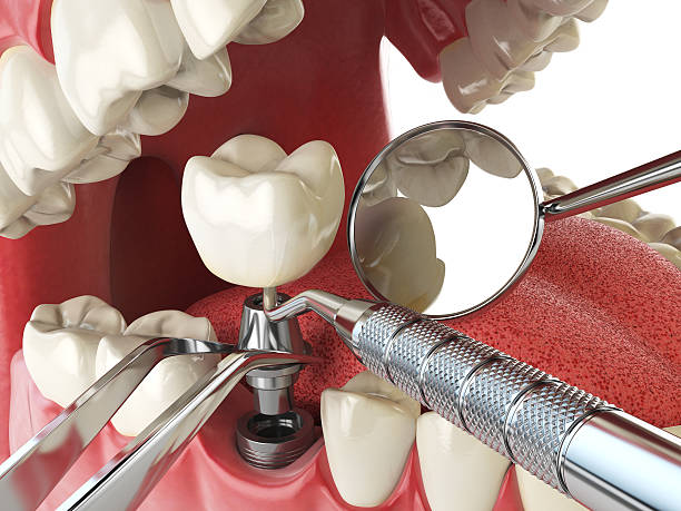 Best Broken or Cracked Tooth Emergency Dentist in Wolf Point, MT
